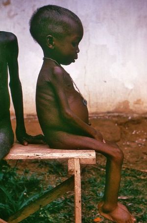 La Banque mondiale appelle à plus d'attention à la crise alimentaire mondiale